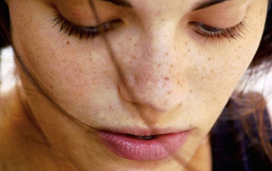 Dark spot removal methods used by women the world over